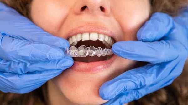 invisalign Newquay 