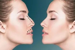 جراحة تجميل الأنف في الرياض